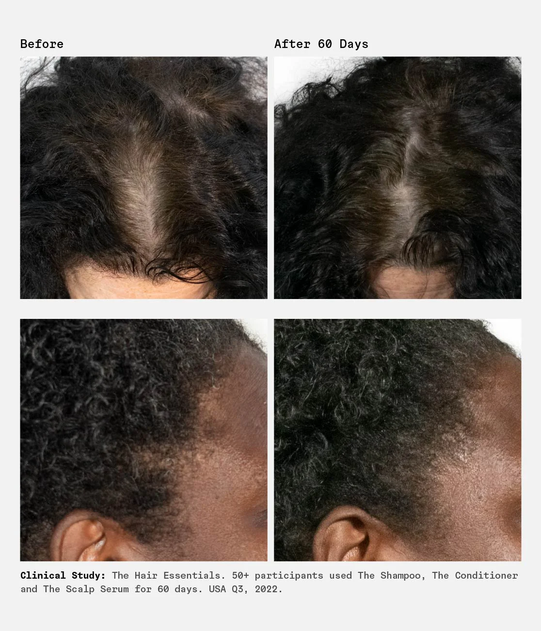 The Scalp Serum Trio | 90-Day Supply | 1% Hyaluronic Acid - Image 5